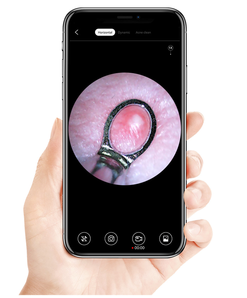 SUNUO X8 Limpiador de Oídos Inteligente con Cámara Visual, Extractor de Acné, Cámara HD de 5MP, Giroscopio de 6 Ejes, Puntas de Silicona para los Oídos, Conexión WiFi