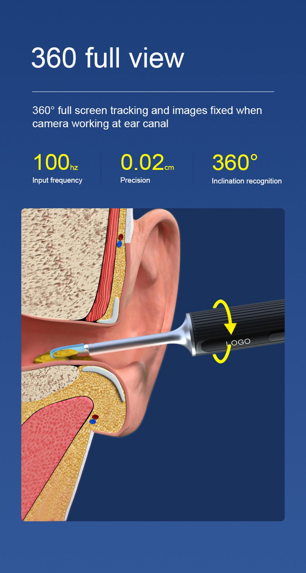 SUNUO X8 Limpiador de Oídos Inteligente con Cámara Visual, Extractor de Acné, Cámara HD de 5MP, Giroscopio de 6 Ejes, Puntas de Silicona para los Oídos, Conexión WiFi
